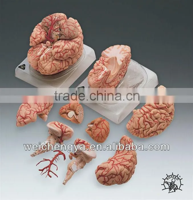 WCY Scale Models Of The Human Brain With Arteries