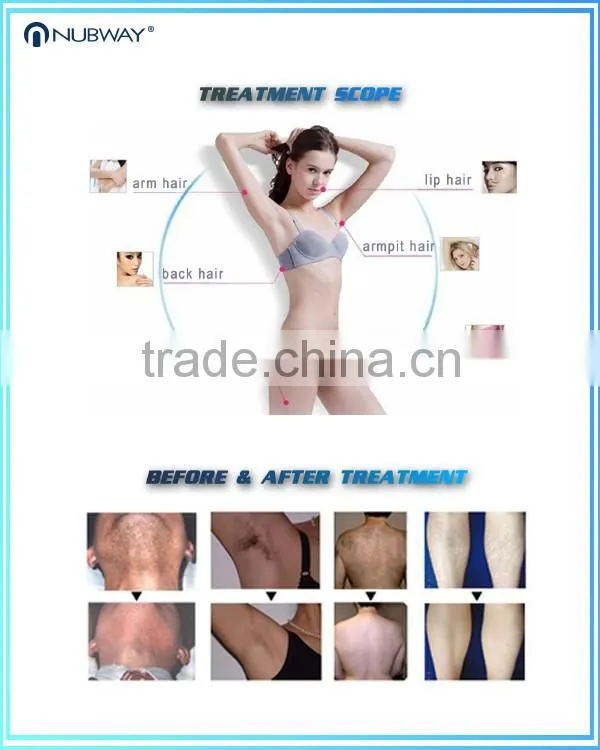 1800W Power High Effective Laser Diode Laser Hair Removal Machine