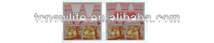 NL-TM800 High qualtiy face lift device thermagic cpt/thermagic rf machine