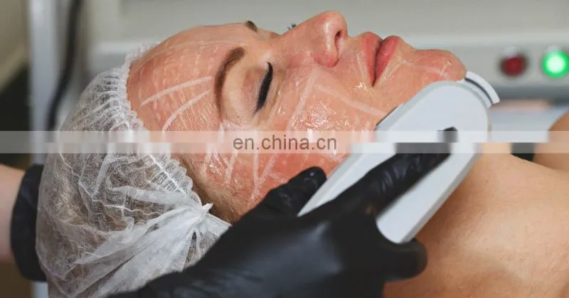 portable wrinkle remover skin tightening face lift anti aging slimming machine