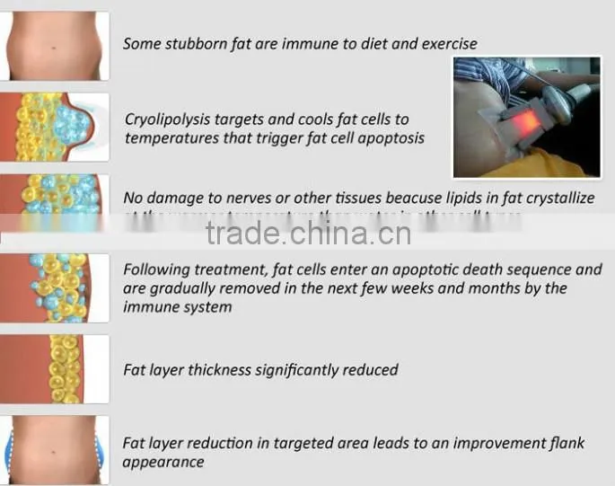 CE fat freezing cryo lipolysis machine with 3 different size handles