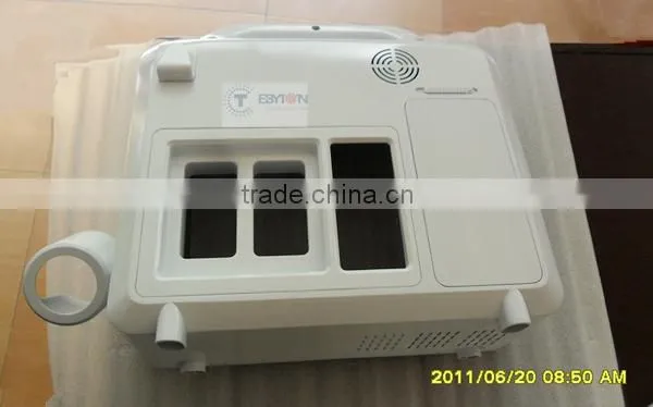 cnc plastic custom machined parts in China