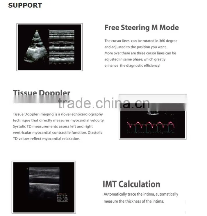 2016 new Portable Color Doppler(Optional 4D) for cardiac use