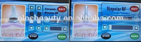 RF Vacuum Roller 40k cavitation slimming machine