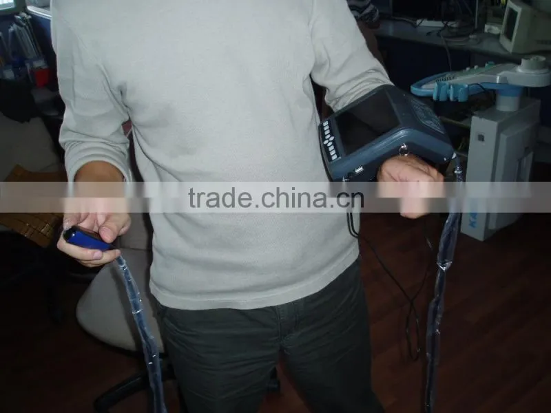 Vet Ultrasound/Veterinary Products/ Diagnostic Equipment for Animal