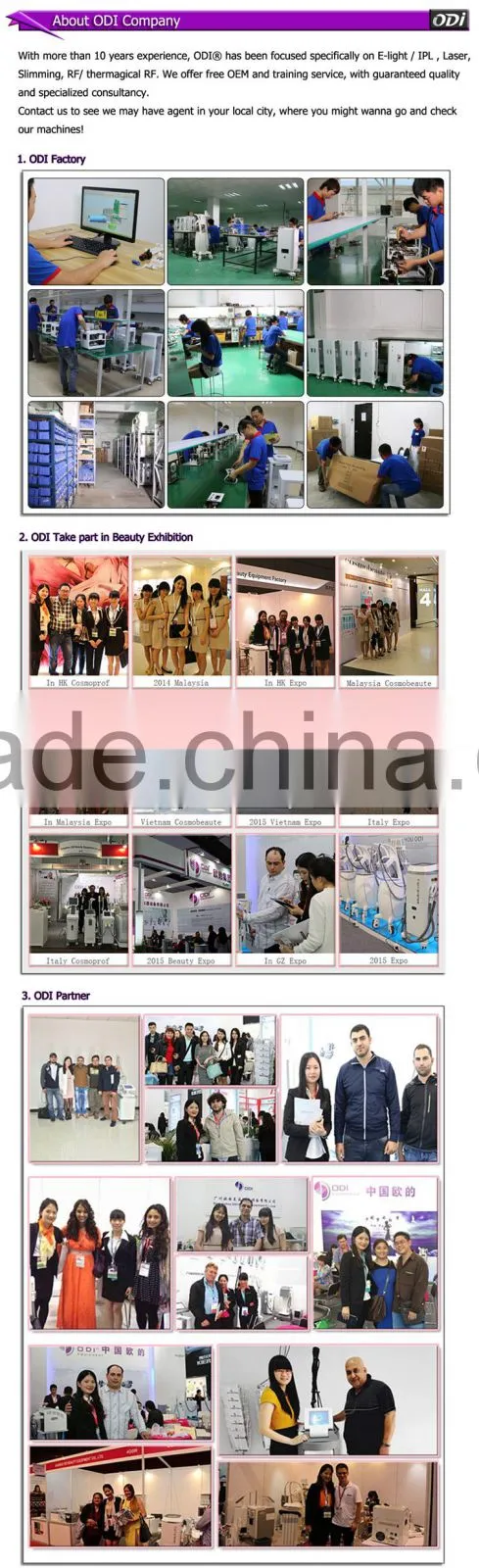 Fast result painless unhairing 808nm diode laser treatment