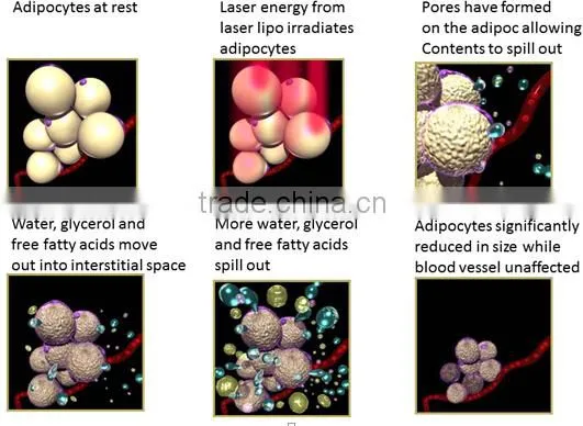 12 paddles 650nm/940nm double wavelength effective diode Lipo Laser for body slimming