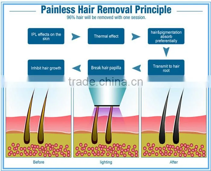 Multifunctional IPL 808nm diode laser hair removal beauty machine