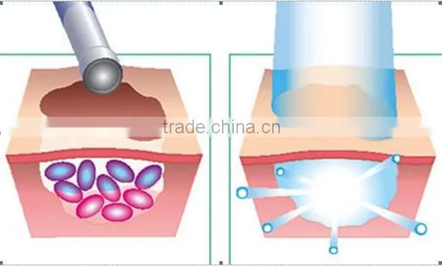 Professional led light pdt photon skin beauty equipment