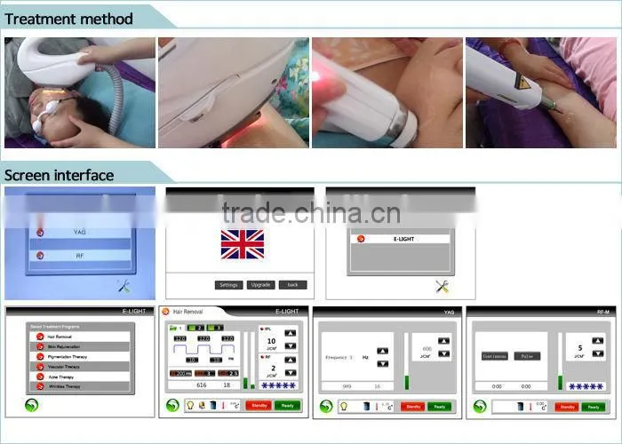elight system for hair remove