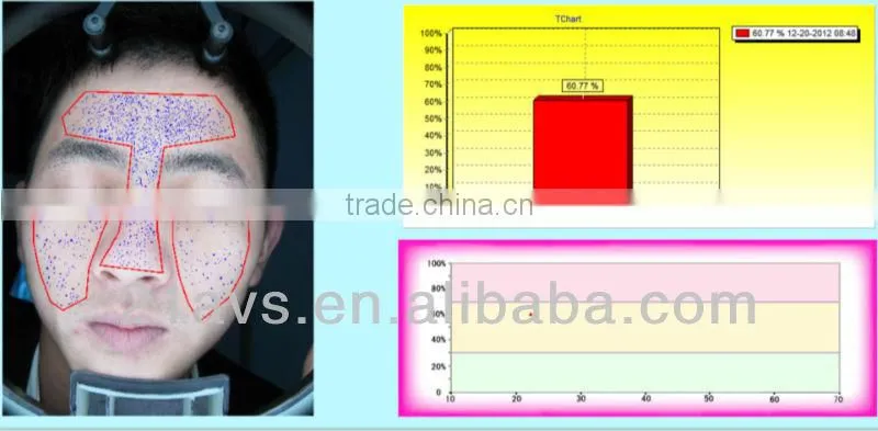 Guangzhou facial skin analysis machine