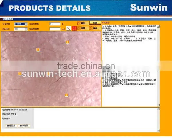 Sunwin manufacturer Full touch screen Professional intelligent skin analyzer