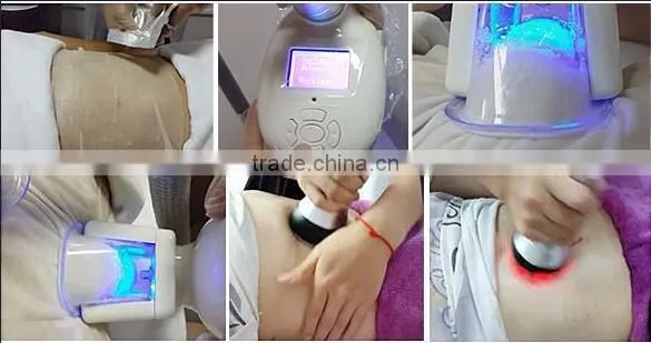 Medical CE approved Cavitation vacuum freezing fat cell cryo slimming machine