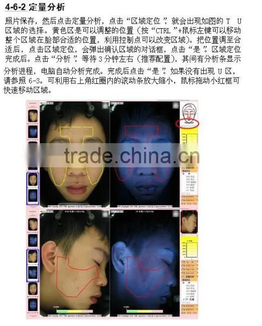 CE Approval skin analysis device, 3D skin scanner system, 3D mirror skin testing system