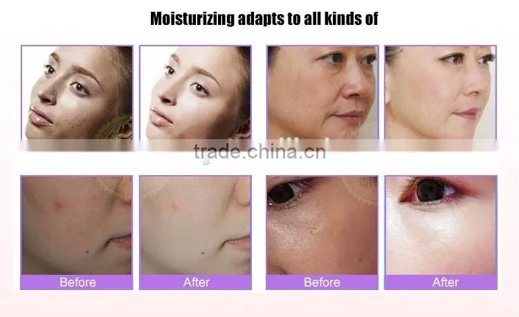 Best thing to sell 12ml usb portable cold and hot facial steamer