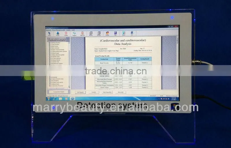 Alibaba website touch pc quantum magnetic resonance analyzer