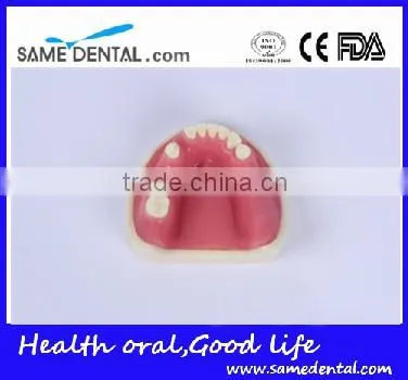 Dental Implant Practice Model With Gingival School Teaching Demonstration Models
