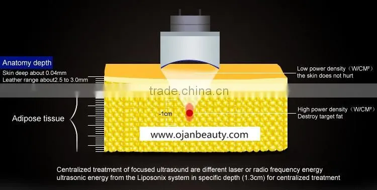 Non-invasive Fat Reduction Liposonic HIFU Machine for Body Slimming