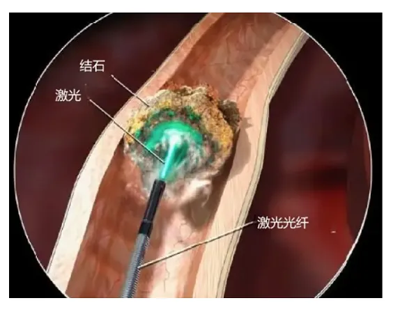 2μm连续准连续激光器5