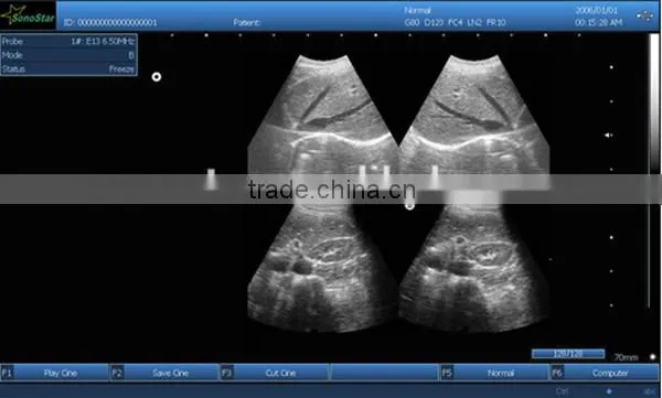 Sonostar hospital veterinary equipment B model ultrasound machine for sale V9