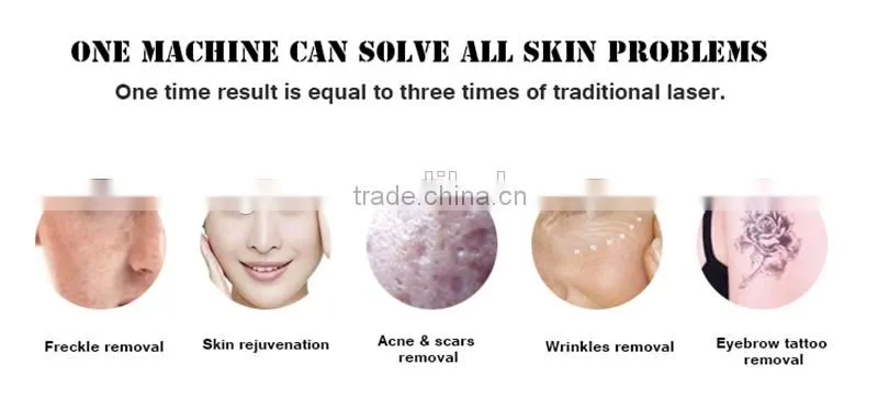 2016 best sale PicoSure Picosecond Laser for tattoo removal picosure laser tattoo removal equipment
