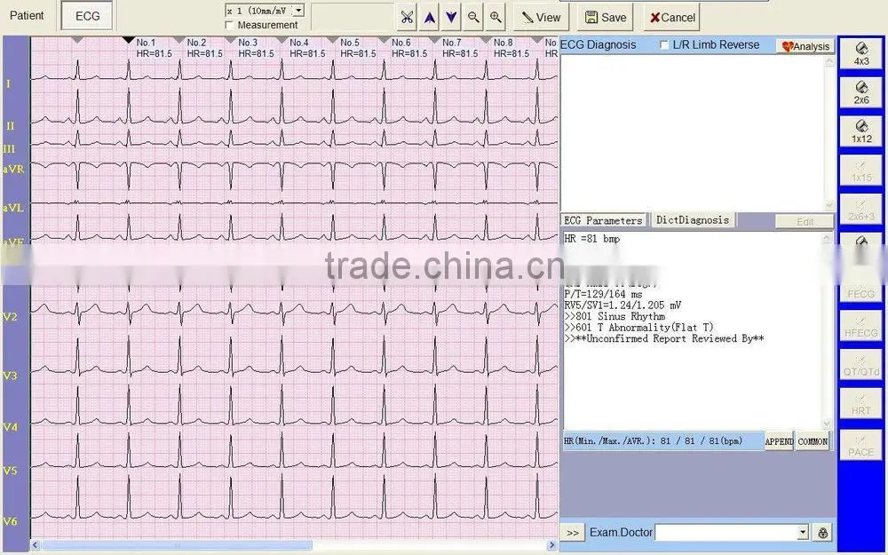Model:3306G 6ch color touch display veterinary ecg