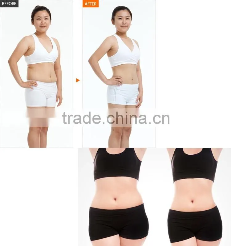 Ali Assurance Microcurrent rf skin tightening machine