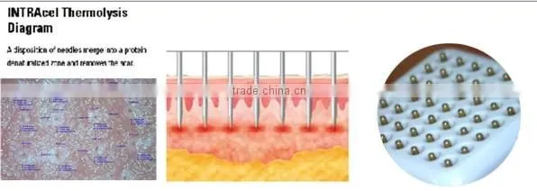 Big Promotion!!! high performed Portable Fractional rf equipment for skin resurfacing