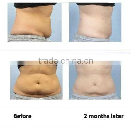 NL-LSR900 Laser ultrasonic cavitation body slimming machine with Bipolar Tripolar RF and 650 nm Laser for fat burning body slim