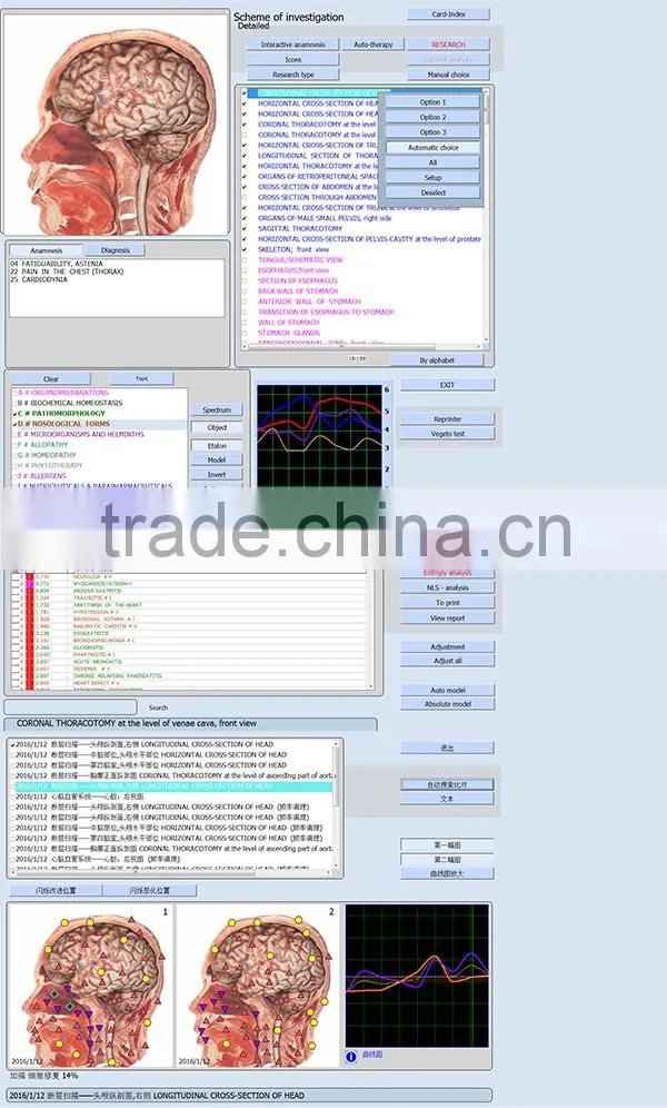Quantum Therapy Machine Quantum Health Analyzer 9D Cell Health Analyzer