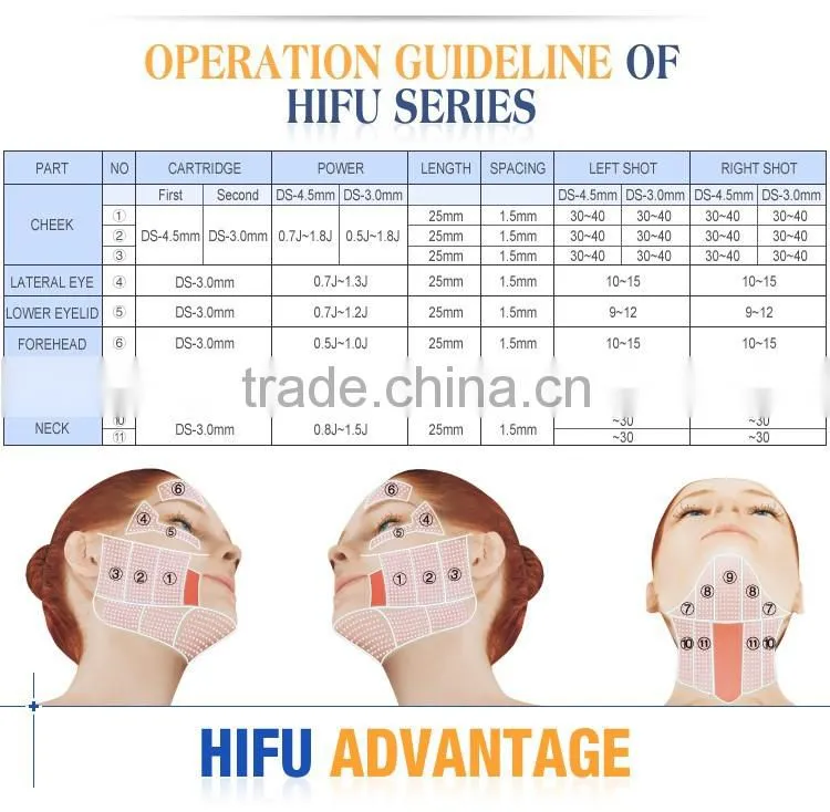 High Intensity Focused Ultrasound Hifu/ Hifu Anti-wrinkle With Amazing Effect