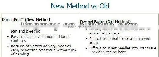 192 pins zgts titanium derma roller for home use tm-086