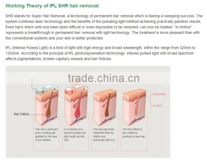 Hot sale IPL laser permanent fast hair removal machine for beauty salon