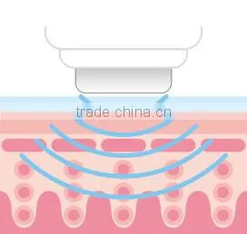 Skin peeling ultrasound machine for home use