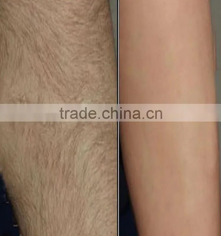 .Permanent IPL SHR Hair Removal / 650-950nm /CE