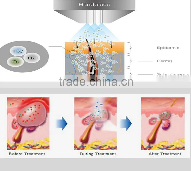 oxygen therapy wrinkle removal skin rejuvenation machine