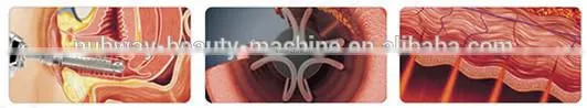 Medical CE FDA Approved Fractional co2 laser for facial resurfacing and ance scars
