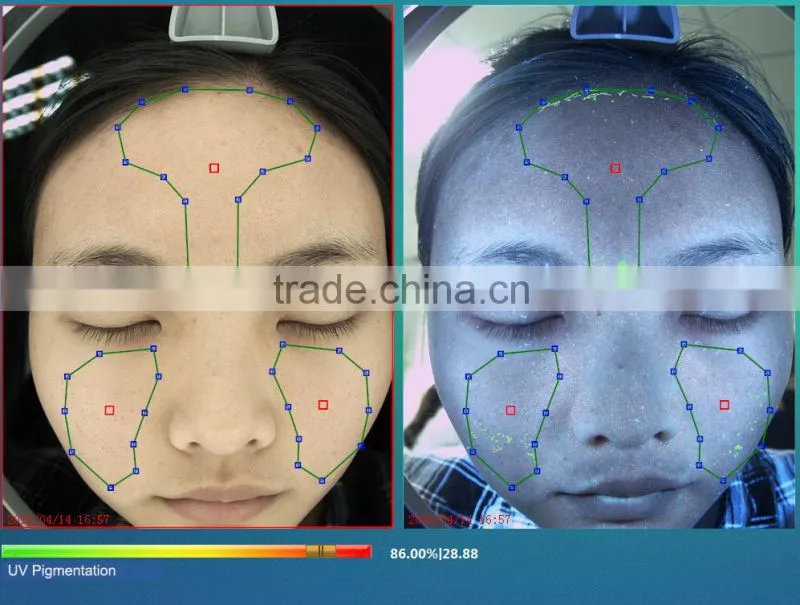 best magic 3d facial skin analyzer with camera beauty salon machine LD6021C