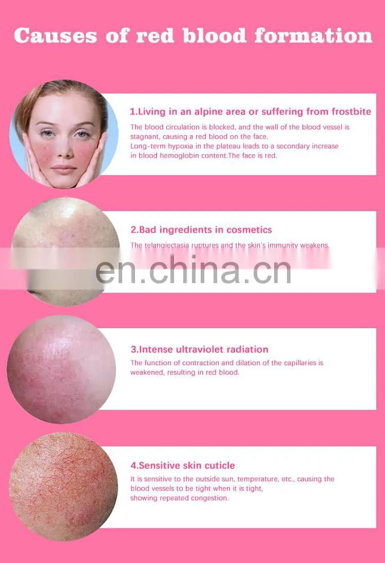 Portable spider veins vascular removal machine for salon use