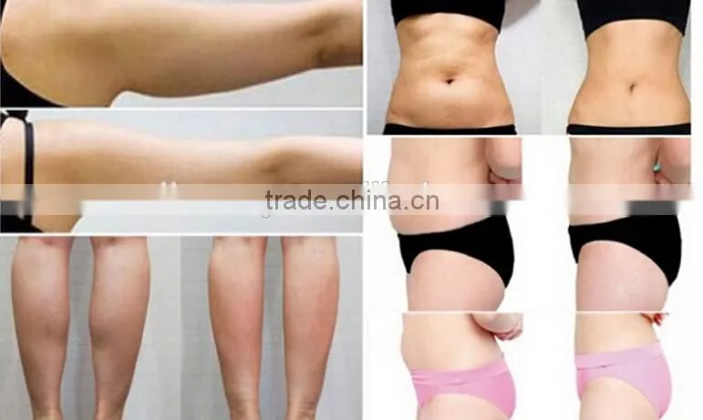 2016 the newest Lipo Hifu Sonic body fat break and skin tightening