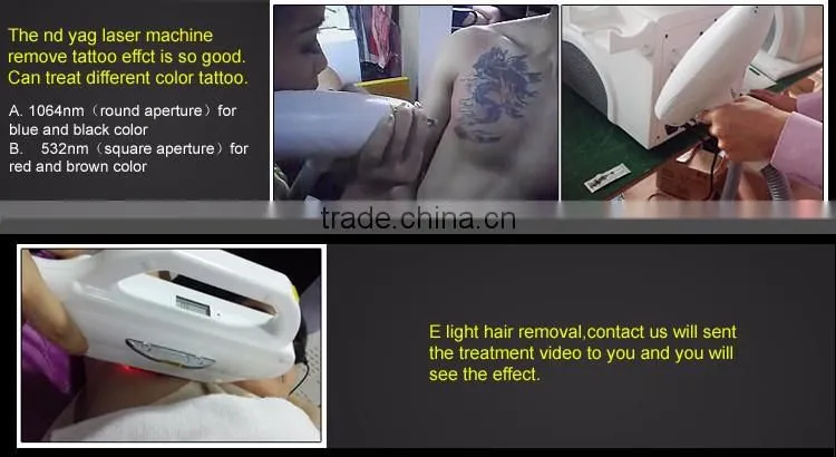High Quality IPL System elight Painless Hair Removal For Body NS-D12