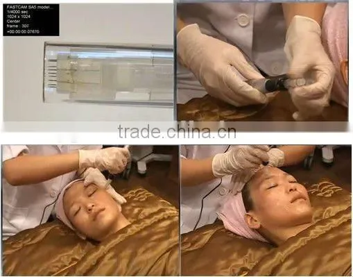 2014 new Auto micro needle pen/electric pen for acne scar removal and wrinkle removal,auto micro needle pen,CE approved