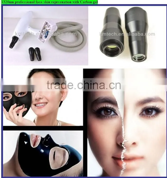 100% good feedback yag ipl 2 in 1 for hot promotion(CE/ISO/TUV)
