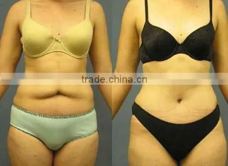 F017 Vacuum cavitation body sculpturing machine for fat removal