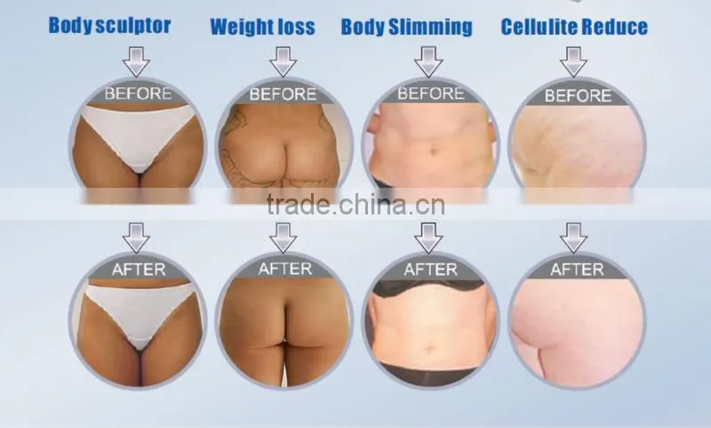 Portable RF Vacuum Roller Slimming Machine With Cavitation For Cellulite Removal
