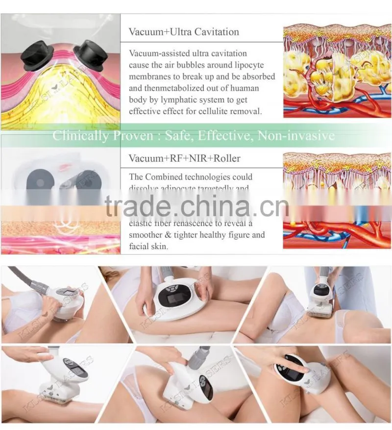 Speedily vibrate fat vacuum cavitation system, vacuum cavitation erosion system