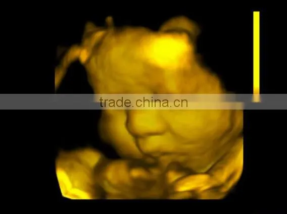 ultrasound machine ,ultrasound machine price,ultrasound scanner