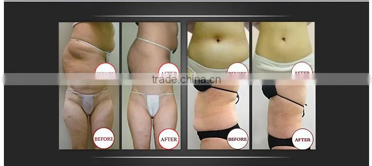 Personal care beauty equipment cold laser lipolysis slimming