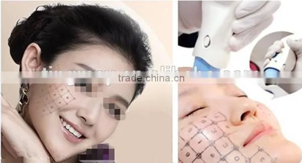 Facial beauty equipment rf fractional/fractional rf machine