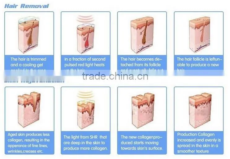 Medical combination best choice IPL handle and SHR (super hair removal) machine